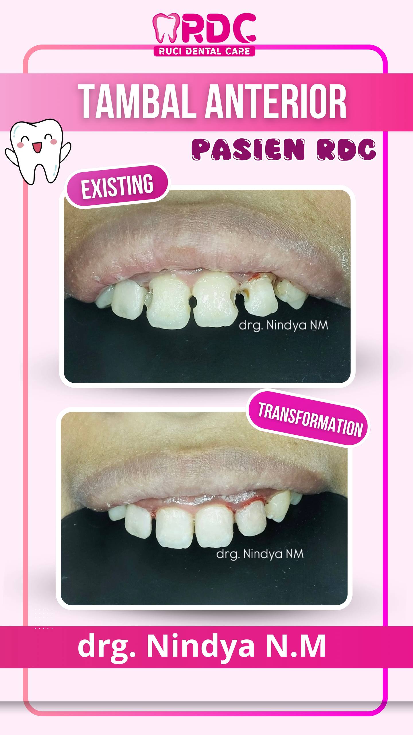 Tambal Gigi