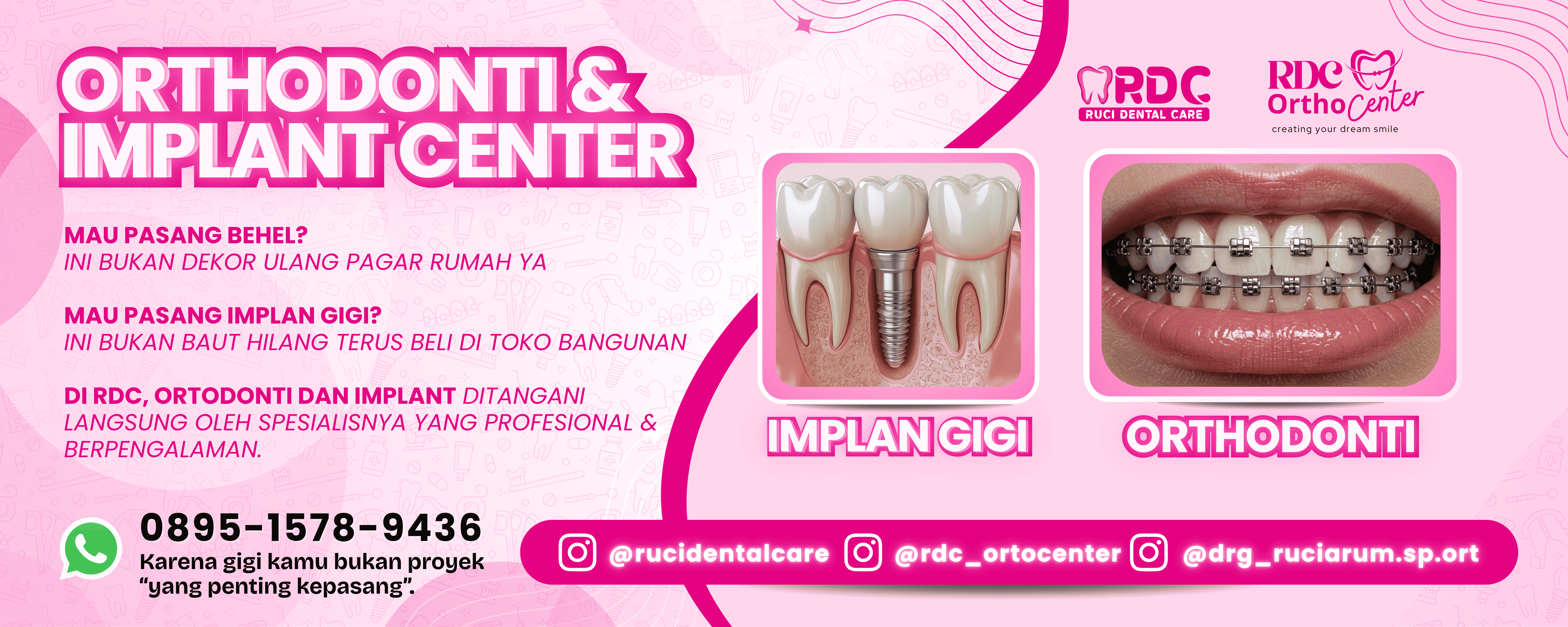 Implan Gigi = Percaya Diri Baru
